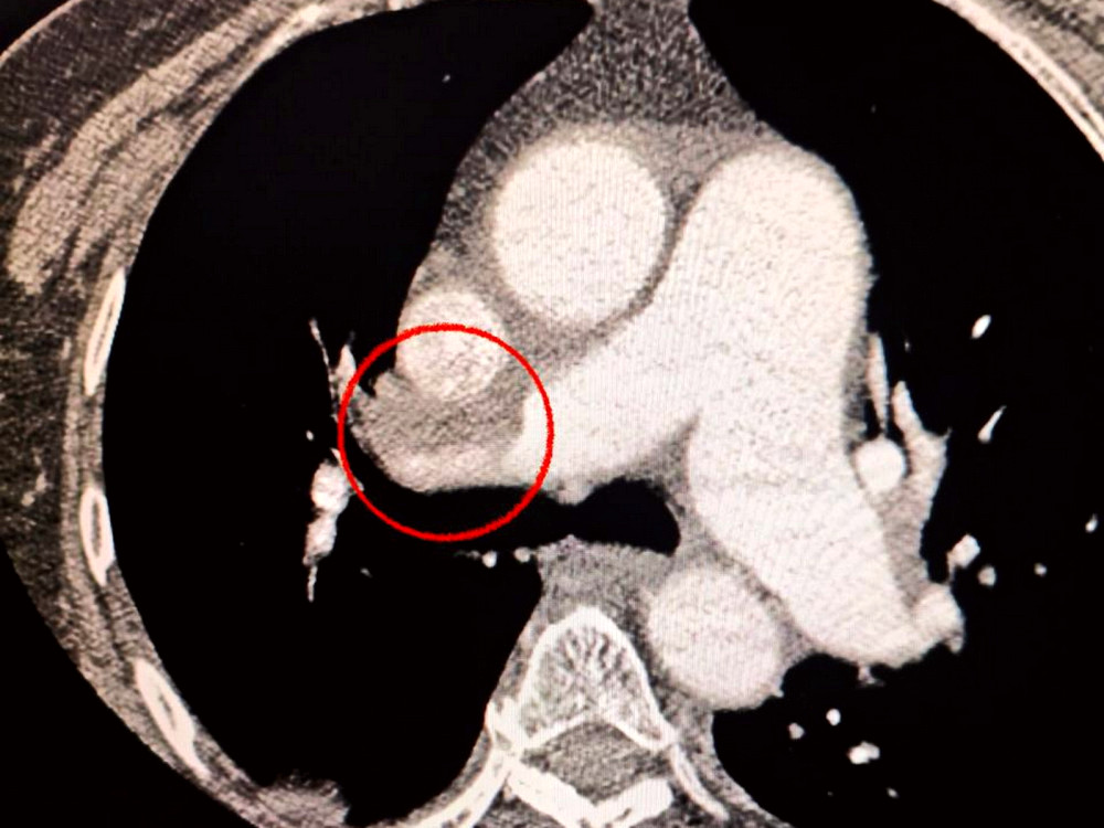 10220 image for slide