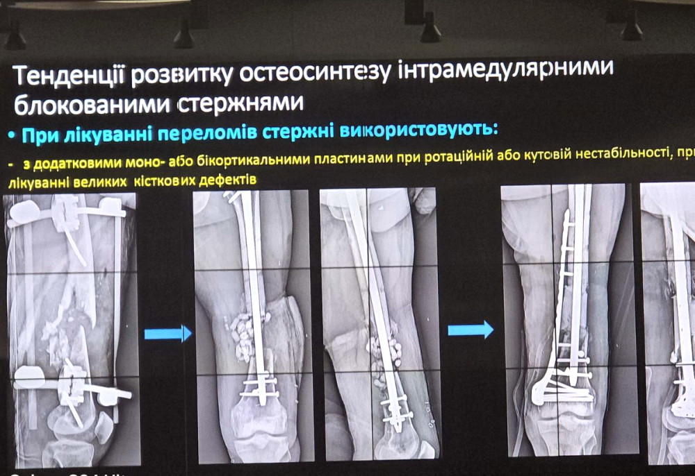 4606 image for slide